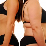 obesity